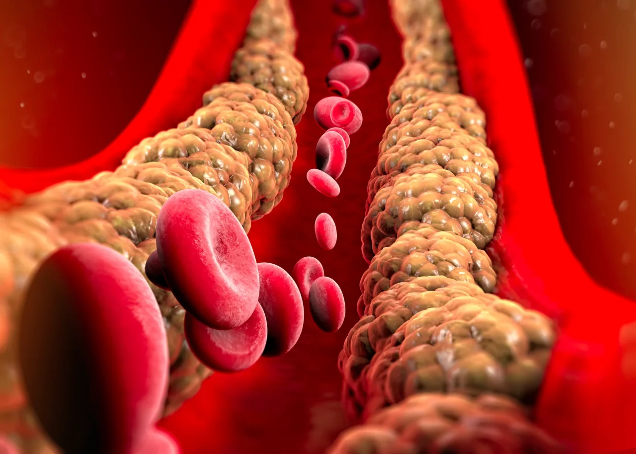 Colesterolo alto? Ecco i due alimenti che lo abbassano senza farmaci Colesterolo alto? Ecco i due alimenti che lo abbassano senza farmaci